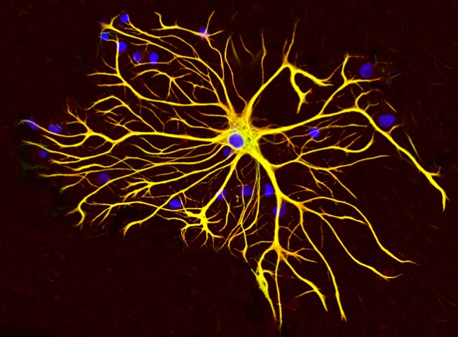 astrocyte